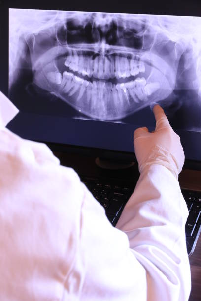 Best After-Hours Emergency Dentist in Ross, CA